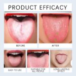 Oralhoe Tongue Cleansing Gel