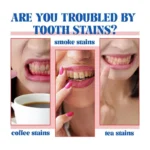 Oralhoe Ultra+ SP-6 Toothpaste for Effective OraHealth Management and Fresh Breath