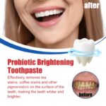Oralhoe Ultra+ SP-6 Toothpaste for Effective OraHealth Management and Fresh Breath
